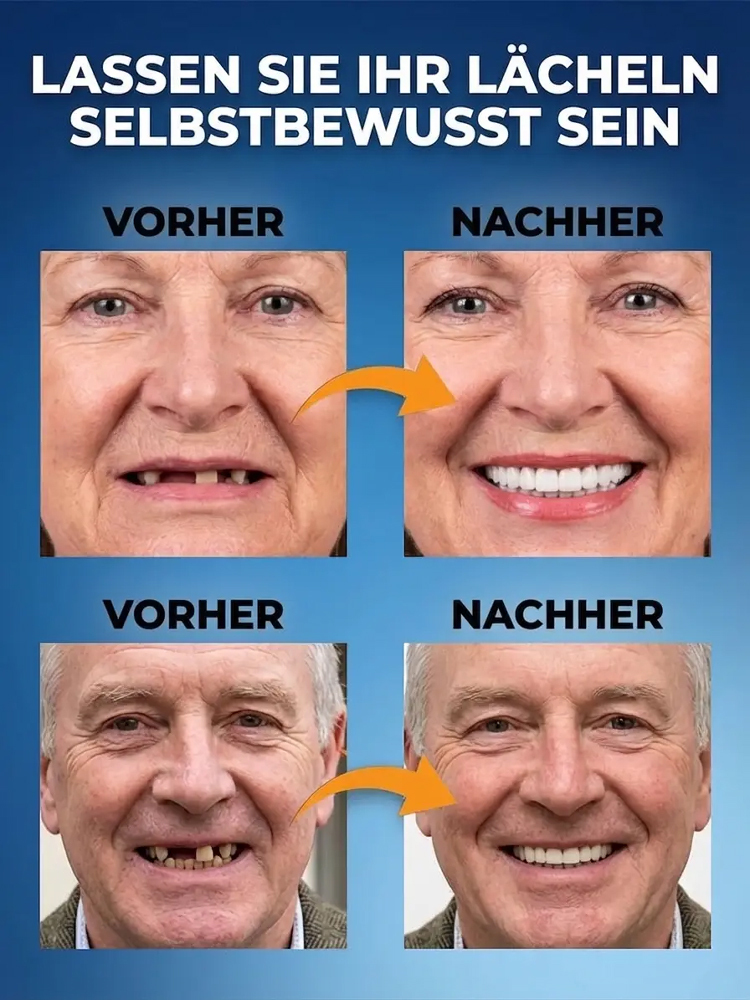 【🦷 Nie wieder Zahnarzt 🦷】Smarte DIY-Prothese: Perfektes Lächeln in 3 Min. ✨