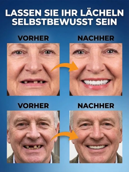 【🦷 Nie wieder Zahnarzt 🦷】Smarte DIY-Prothese: Perfektes Lächeln in 3 Min. ✨