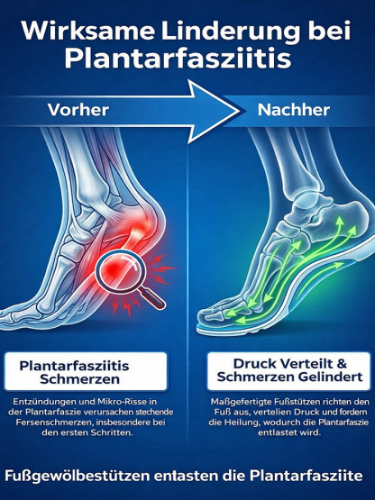 【💯 Gehen wie auf Wolken! 💯】Magnetische Akupressur-Sohlen 🦶 Vitalität in 3 Min. spüren. ✨ Nur heute: 50% Rabatt & 1+1 GRATIS!