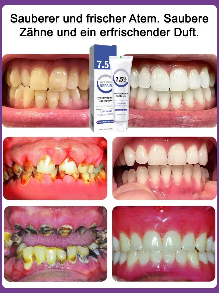 Hydroxyapatit-Zahnpasta – Für sichtbare Ergebnisse nach nur einer Anwendung 