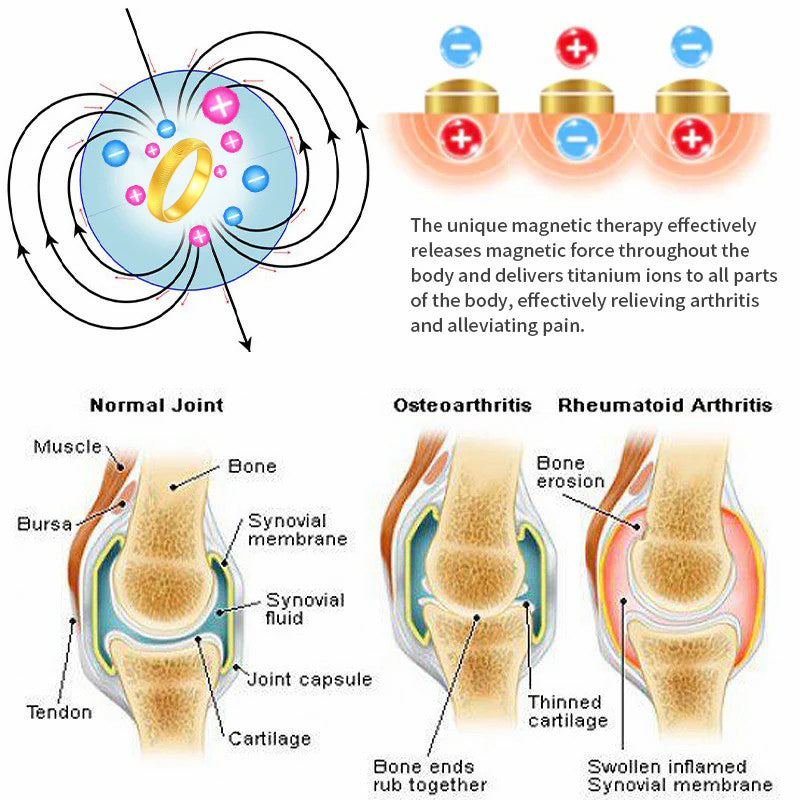（🔥LAST DAY SALE-80% OFF) DIYSTAR💖cats eye ring