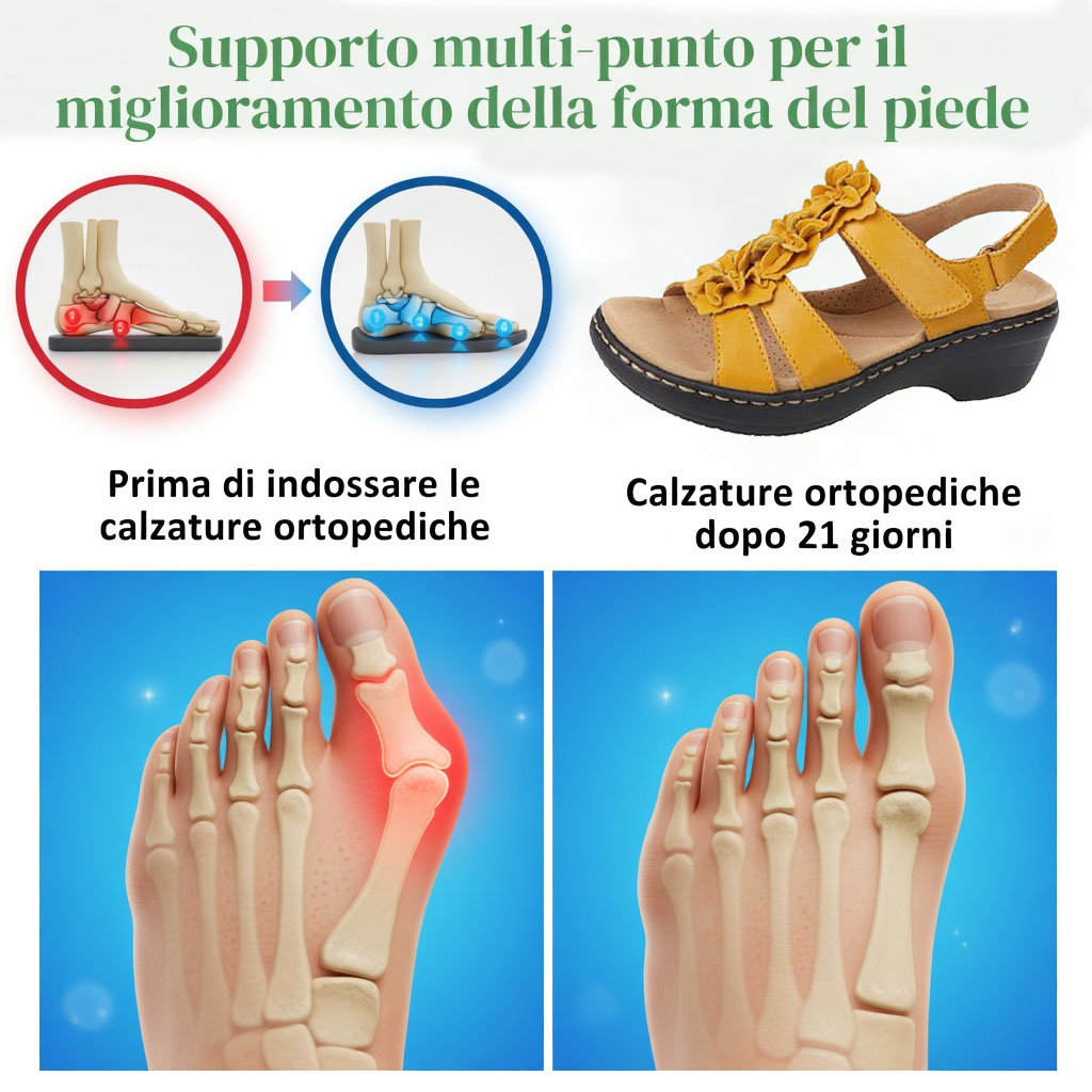 ✅Sandali di alta qualità🦶 Realizzati su misura per le donne - Impermeabili, antiscivolo🔴 Scarpe ortopediche