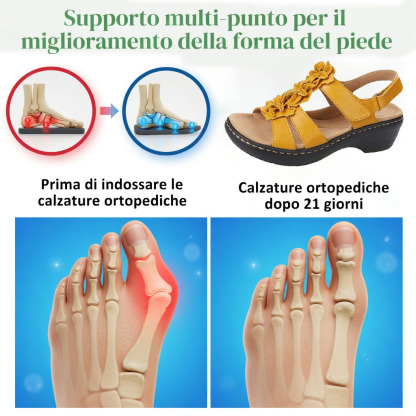 ✅Sandali di alta qualità🦶 Realizzati su misura per le donne - Impermeabili, antiscivolo🔴 Scarpe ortopediche