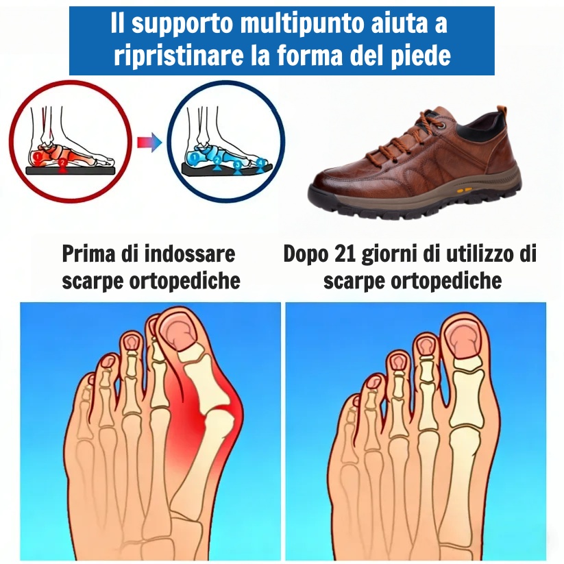 🎁Offerta a tempo limitato🐂 Scarpe ortopediche da uomo, realizzate in pelle di vitello australiana👞 cucite a mano, impermeabili e antiscivolo✅ supporto dell'arco plantare - camminata confortevole