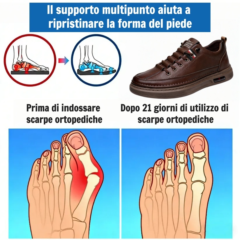 🎁Offerta speciale per l'anniversario: non perdetevela!🎁Scarpe ortopediche in pelle di alta qualità👞Ammortizzazione e sollievo dalla pressione ✅Stabilità e resistenza allo scivolamento ✅Comfort per tutto il giorno