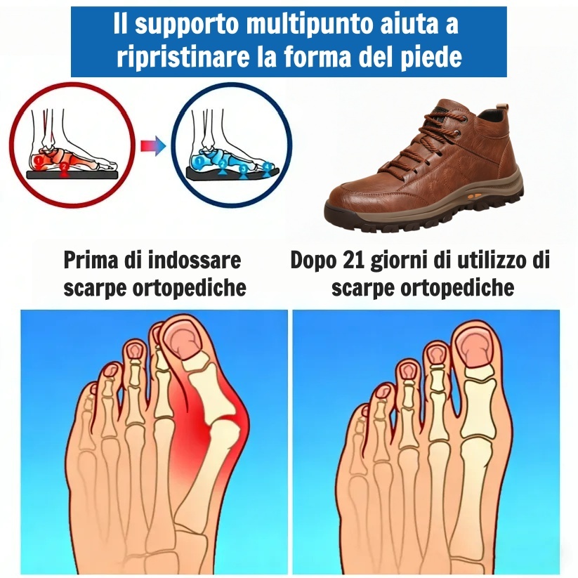 🎁Offerta speciale con il 50% di sconto🐂 Scarpe ortopediche da uomo, realizzate in pelle di vitello australiana👞 cucite a mano, impermeabili e antiscivolo✅, con supporto plantare - camminata confortevole.