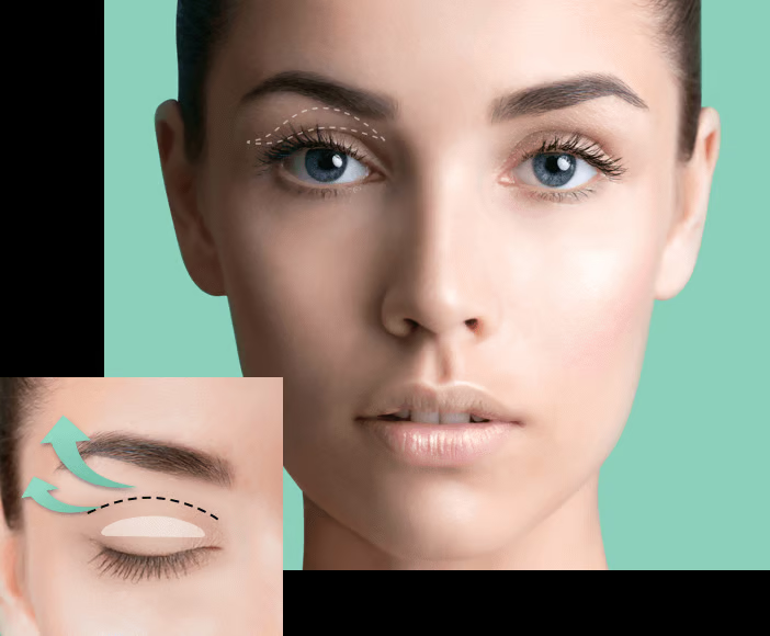 Waterproof Double Eyelid Tapes