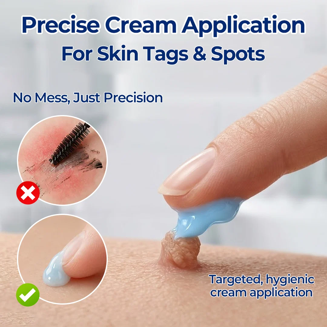 Aurethix®7-Day Skin Tag & Spot Eraser Cream