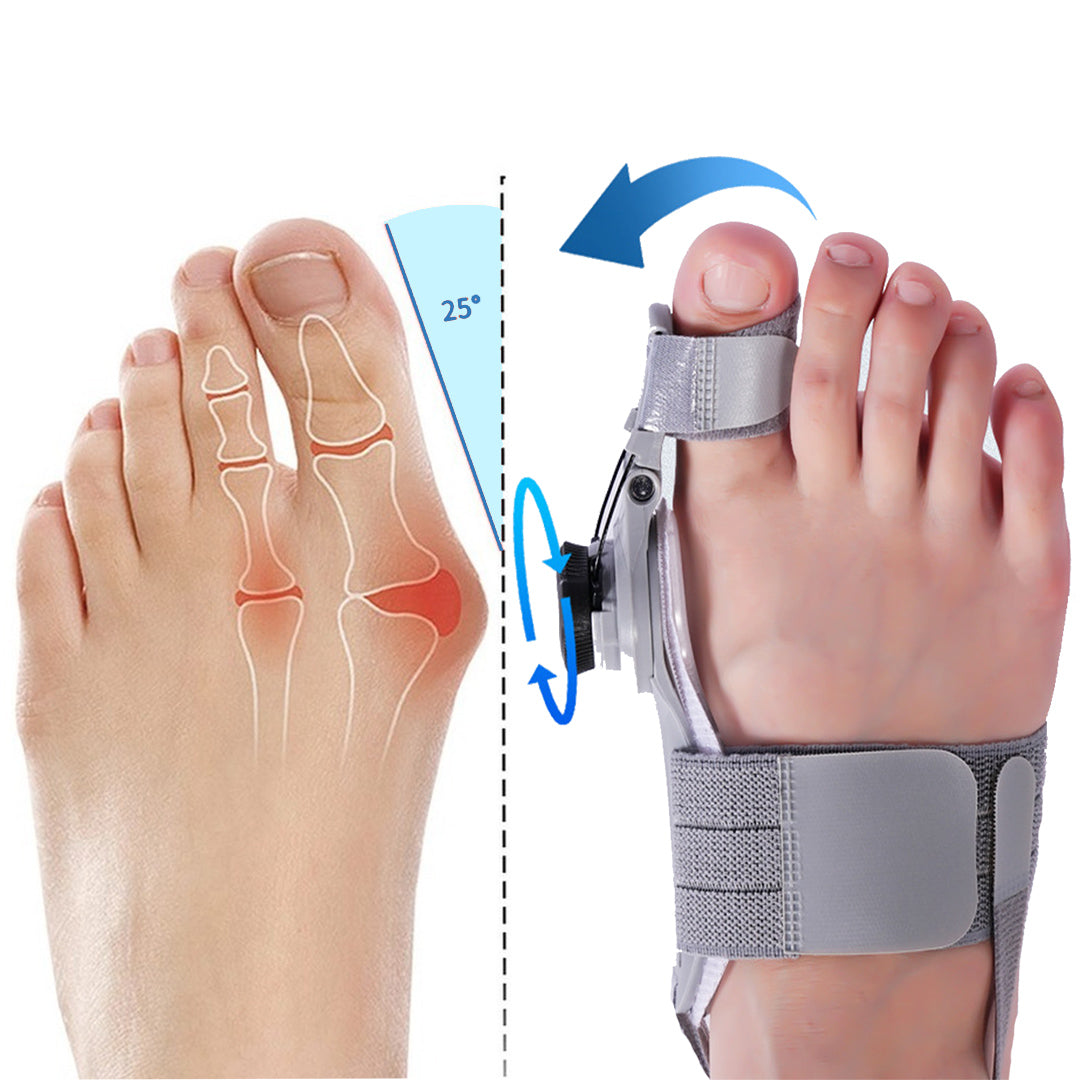 Upgraded Treatmedy Natural At-Home Bunion Relief