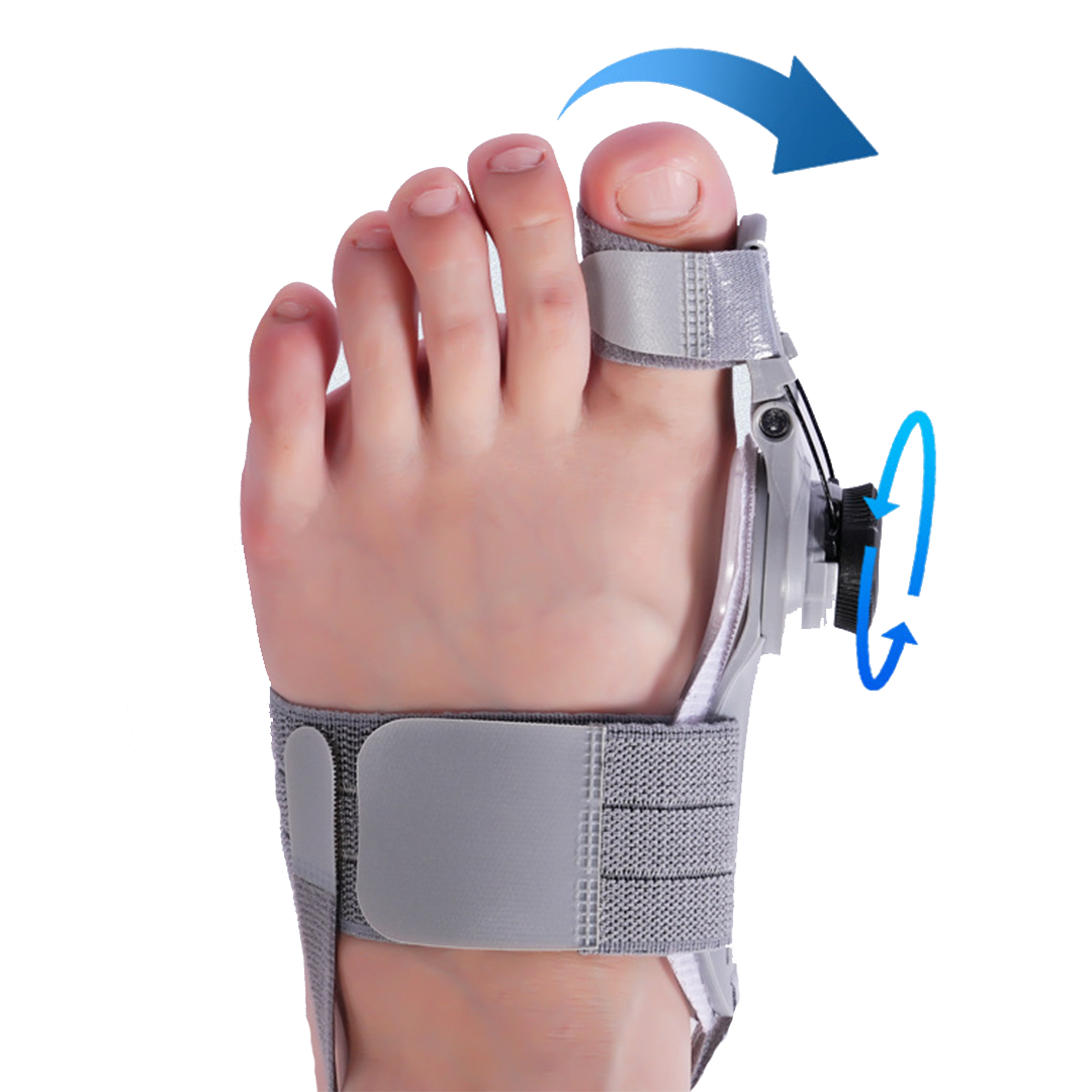 Upgraded Treatmedy Natural At-Home Bunion Relief