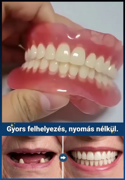Azonnali tökéletes mosoly, kétféle színű műfogsor doboz