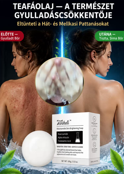 Bőrtónus-Egységesítő Niacinamide Szappan (100g) – Háromszoros Tisztító Formula (Alfa-Arbutin + Tranexámsav), 8 Aktív Hatóanyag, EU-Szabvány Szerinti Biztonság – Hivatalos 50% Raktárkisöprés!