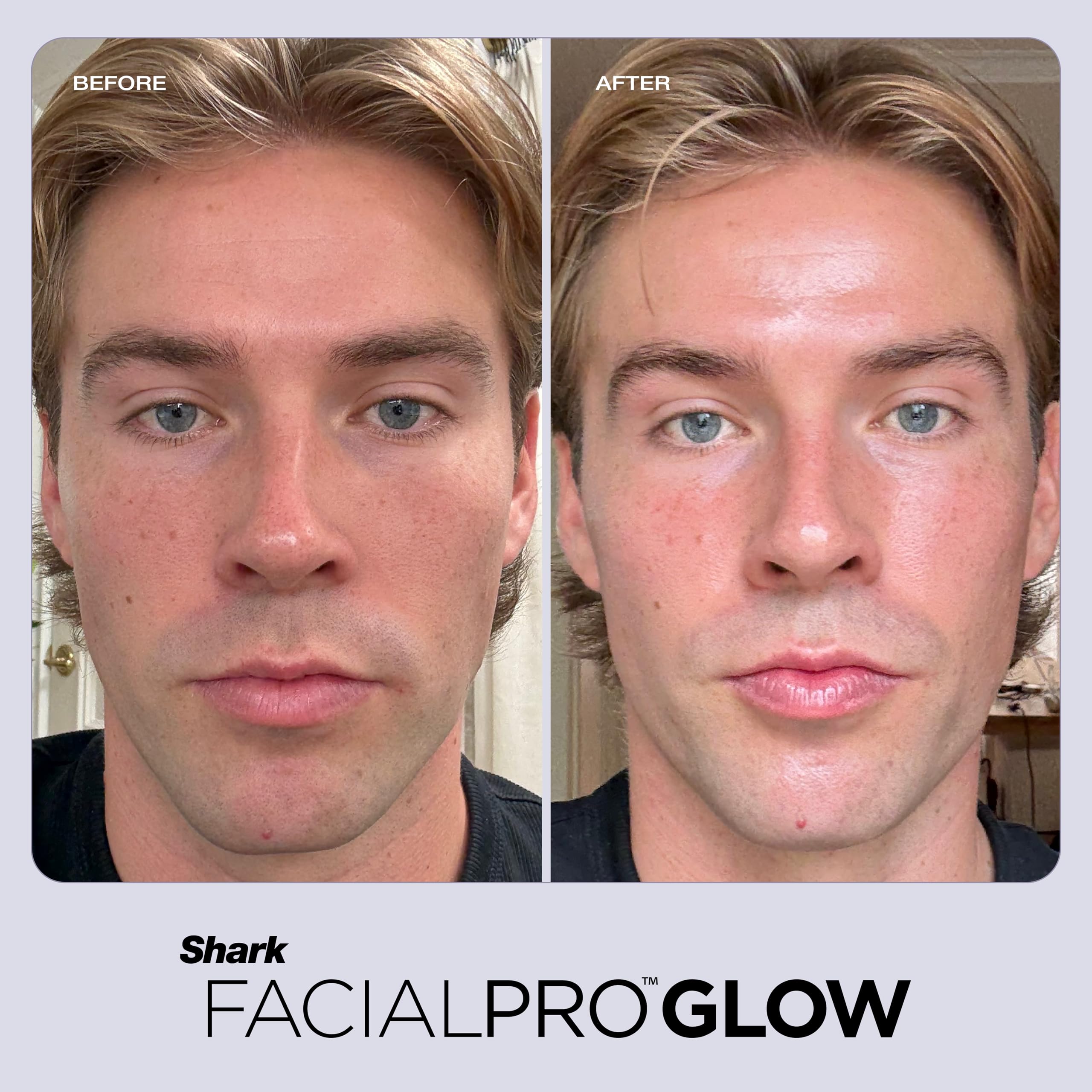 FacialPro Glow 3-in-1 Hydro Facial Device | Pore Cleansing & Hydration