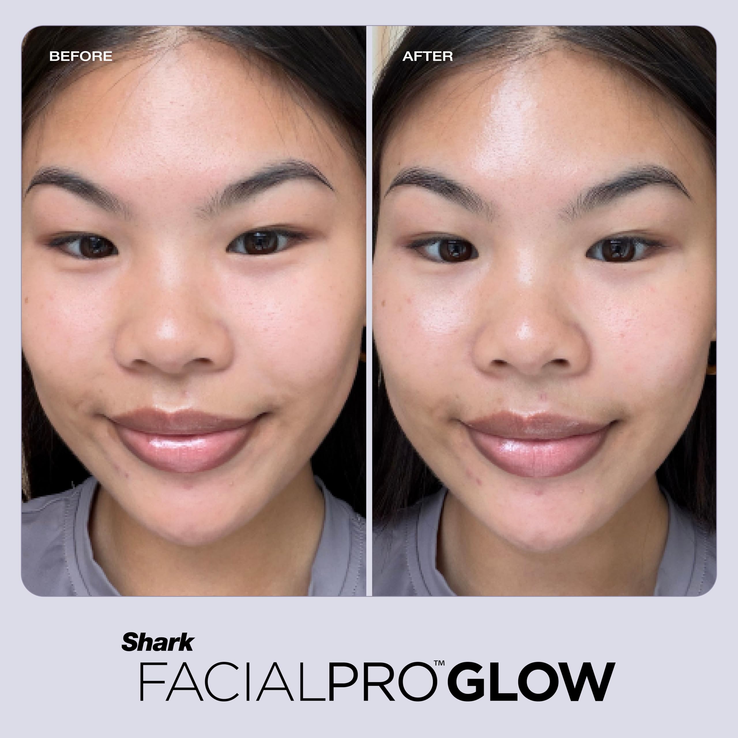 FacialPro Glow 3-in-1 Hydro Facial Device | Pore Cleansing & Hydration