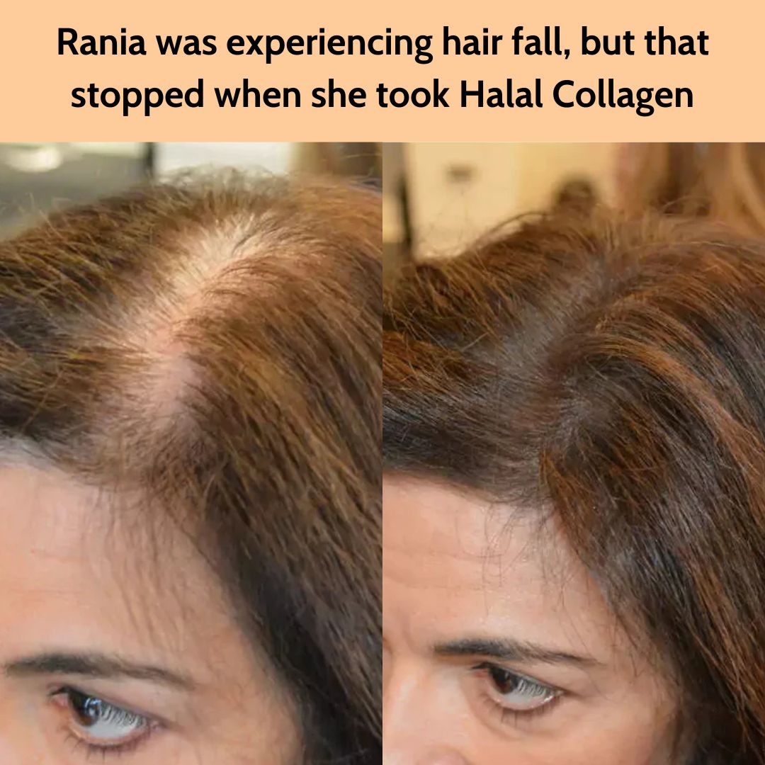"I&rsquo;m honestly shocked! After just 90 days of taking Halal Collagen, my hair has started growing back thicker and healthier. I feel so much more confident, and I&rsquo;m beyond grateful for this change. I only wish I had started sooner!" - Rania