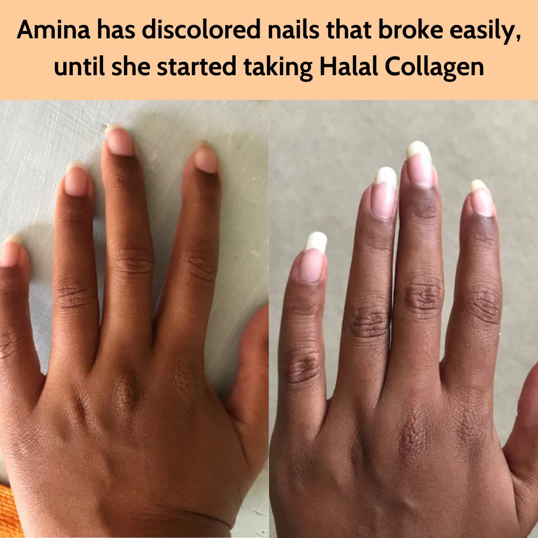 "I&rsquo;ve been taking collagen for 10 weeks now, and my nails have completely transformed! They used to be weak and brittle, but now they&rsquo;re stronger, grow faster, and look so much healthier. Even my friends have noticed and keep complimenting how nice they look!" - Amina