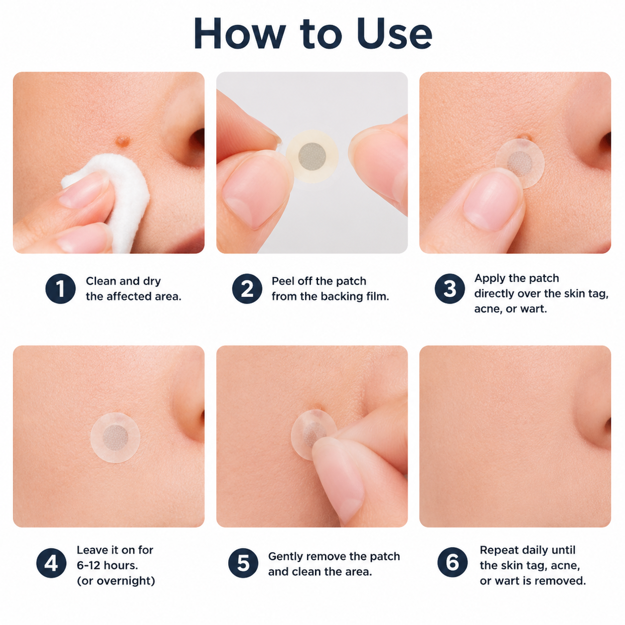 2-in-1 Microneedle & Hydrocolloid Patch🍀| Removes Raised Moles, Acne, Flat Warts & Skin Tags | Helps Improve Wrinkles, Scars & Blemishes | Invisible Patches for Face & Body