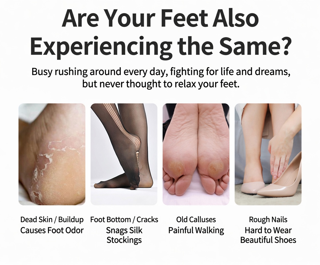 Electric foot file: Easily removes calluses and dead skin from feet.