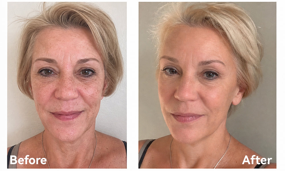 Real People Before and After Result