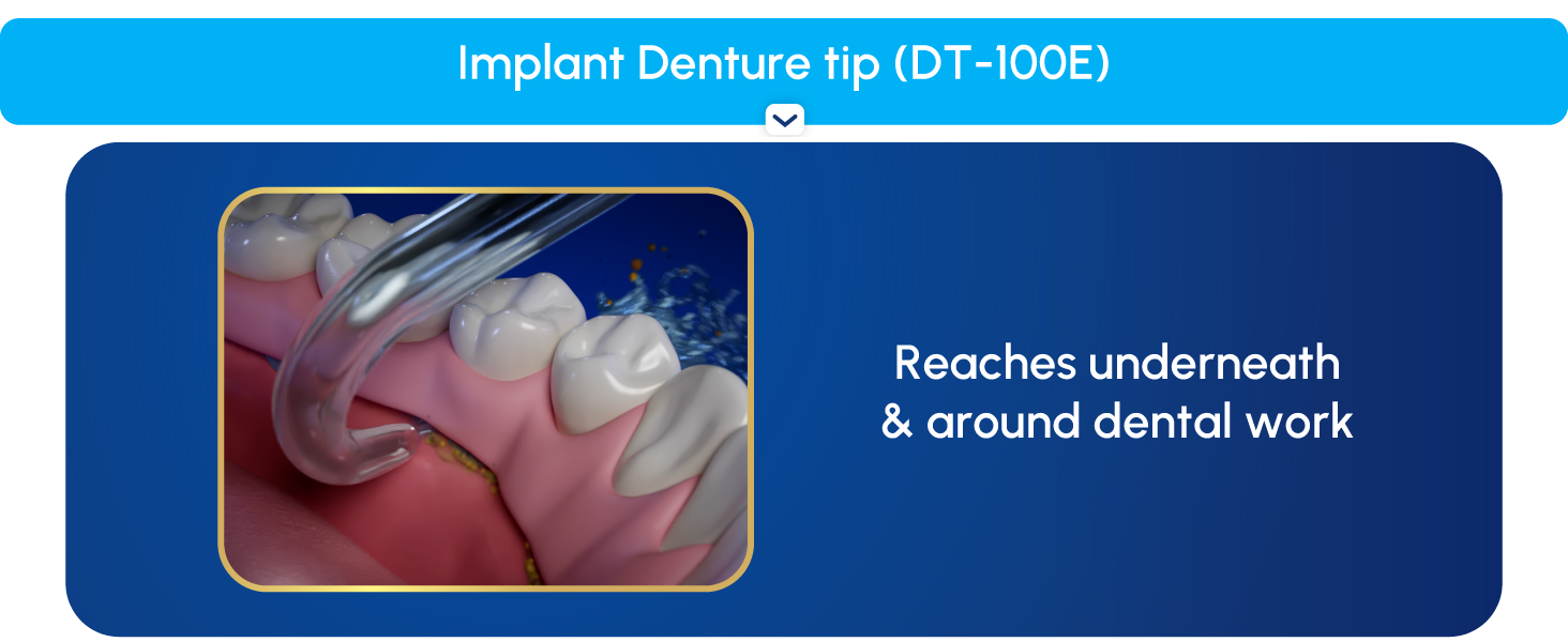 Image of Implant Denture tip and text reading reaches underneath &amp;amp; around dental work.