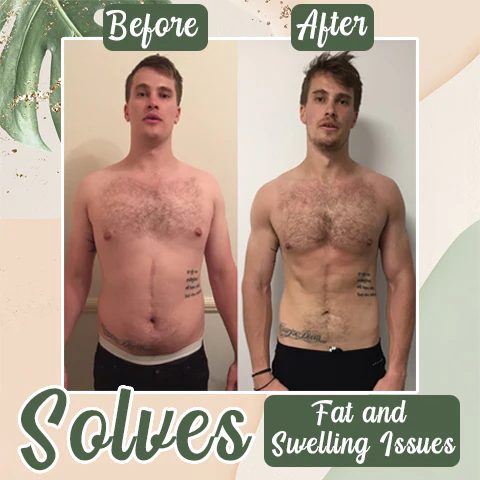 Tökéletes méregtelenítő karcsúsító tapasz (korlátozott ideig érvényes ajánlat🔥utolsó nap)