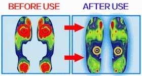 Skin-friendly orthopedic sandals