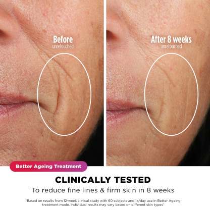 Shark CryoGlow Under-Eye Cooling + LED Face Mask