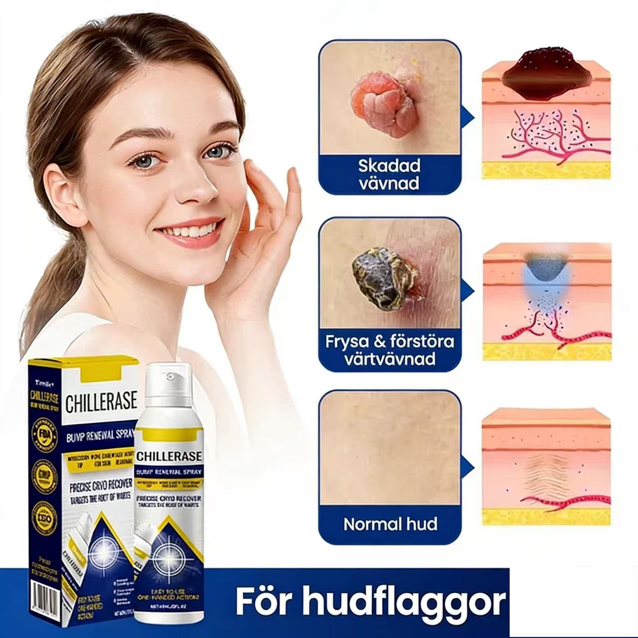 ChillErase förnyande spray för magen ⏰50 % rabatt under en begränsad tid – köp 3, få 2 🔥