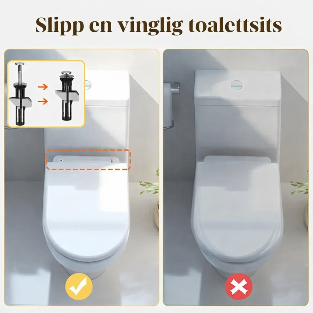 🎅 Saint's Day Exclusive Offer! 50% Off ✨ Click and Apply🔥LAST DAY -BUY 1 GET 1 FREE🔥Heavy Duty Toilet Seat Fixing Screws