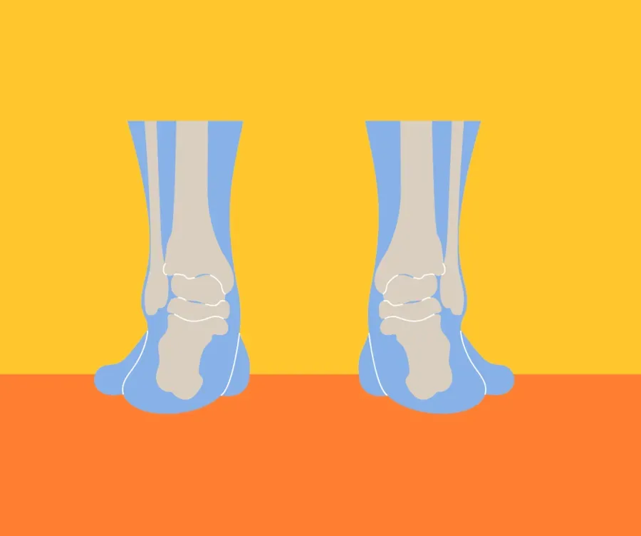 Deep Heel Cup Stability