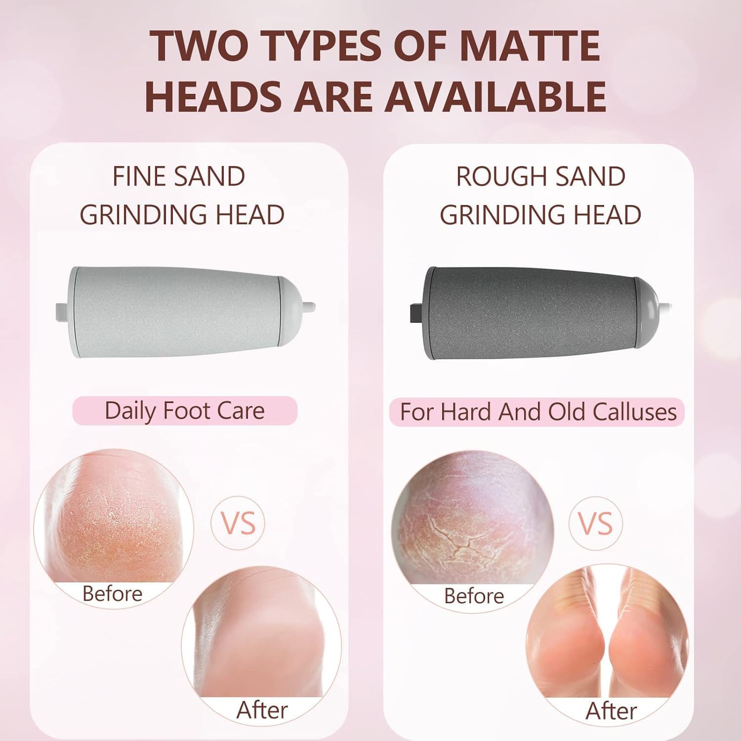 Electric Foot File and Callus Remover