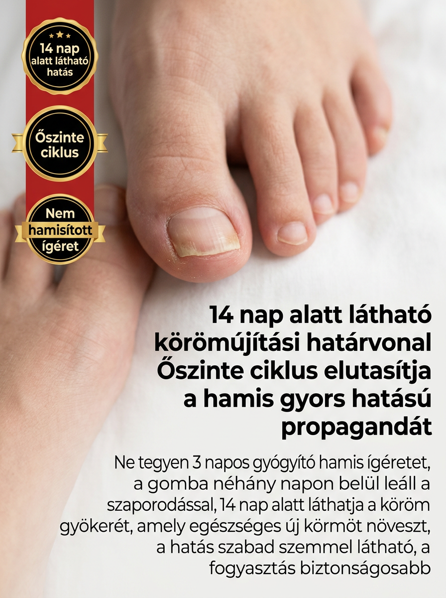 【Fájdalommentes körömújítás】Gyógynövényes, kíméletes körömregeneráló folyadék körömgomba ellen
