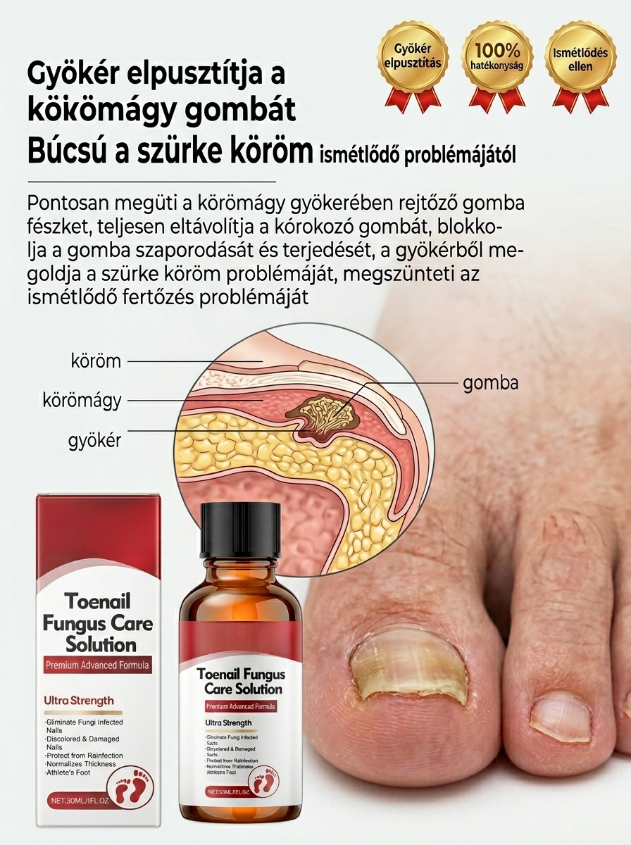 【Fájdalommentes körömújítás】Gyógynövényes, kíméletes körömregeneráló folyadék körömgomba ellen