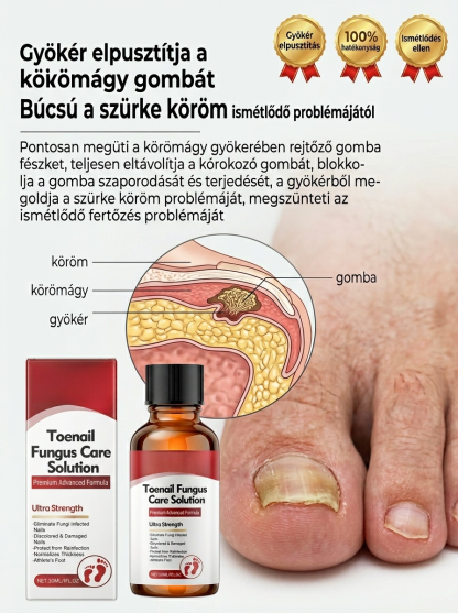 【Fájdalommentes körömújítás】Gyógynövényes, kíméletes körömregeneráló folyadék körömgomba ellen