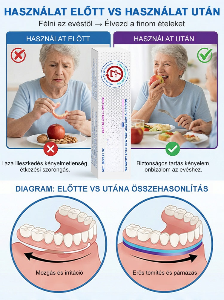 Élelmiszeripari minőségű hőre lágyuló fogsorragasztó
