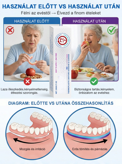 Élelmiszeripari minőségű hőre lágyuló fogsorragasztó