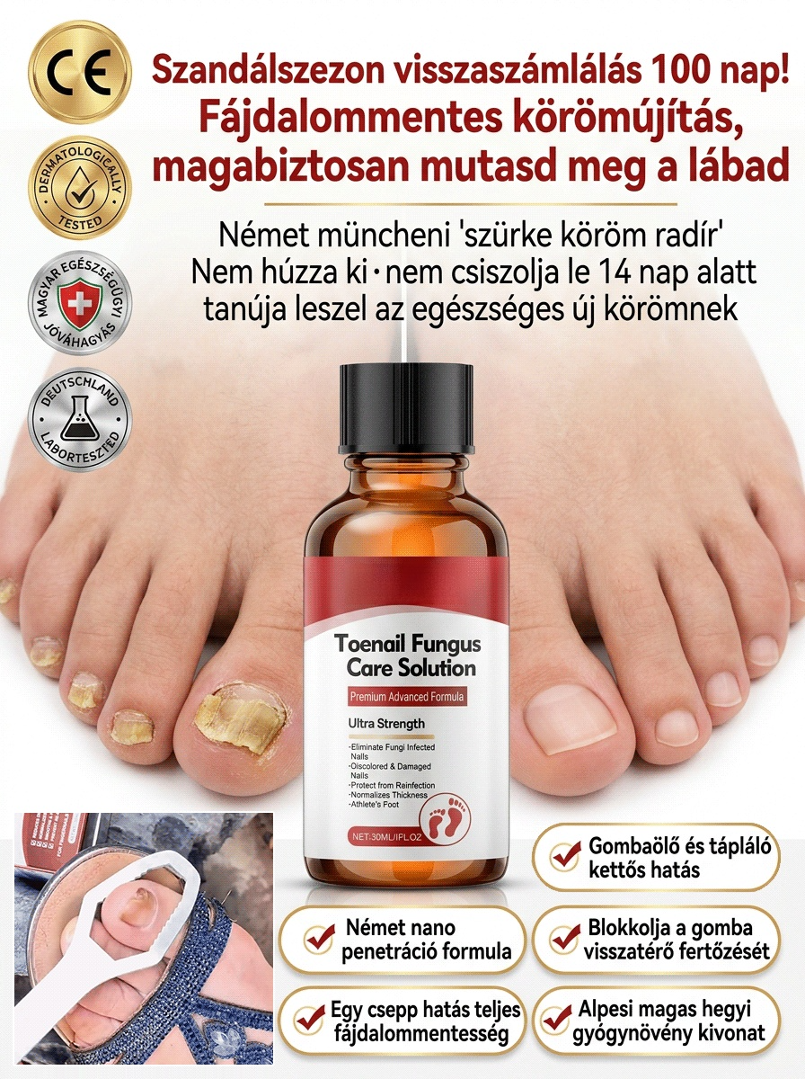 【Fájdalommentes körömújítás】Gyógynövényes, kíméletes körömregeneráló folyadék körömgomba ellen