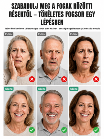 🦷👄Orvosi minőségű teljes műfogsor koronák|Stabil, Kényelmes és Fájdalommentes Megoldás!| Ragasztó Nélküli, 8x Erősebb Tapadás | Tökéletes Mosoly 3 Perc Alatt| Hiányzó Fogak Azonnali Elrejtése |  Azonnali Hollywoodi Mosoly😁✨
