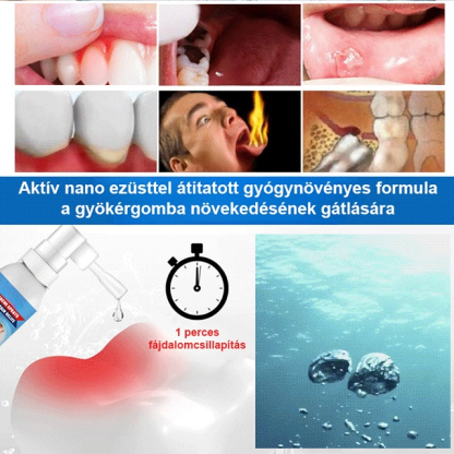 Fogságban a fájdalom, azonnal megállítja a fogfájást.
