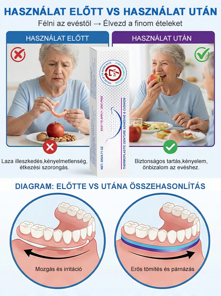 【1 Kenés = 7 Nap Tartás】100% Cinkmentes Hőplasztikus Műfogsor Párna | Zárja ki az Ételmaradékot, Harapj Bátran!