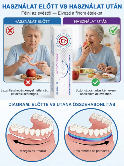 【1 Kenés = 7 Nap Tartás】100% Cinkmentes Hőplasztikus Műfogsor Párna | Zárja ki az Ételmaradékot, Harapj Bátran!