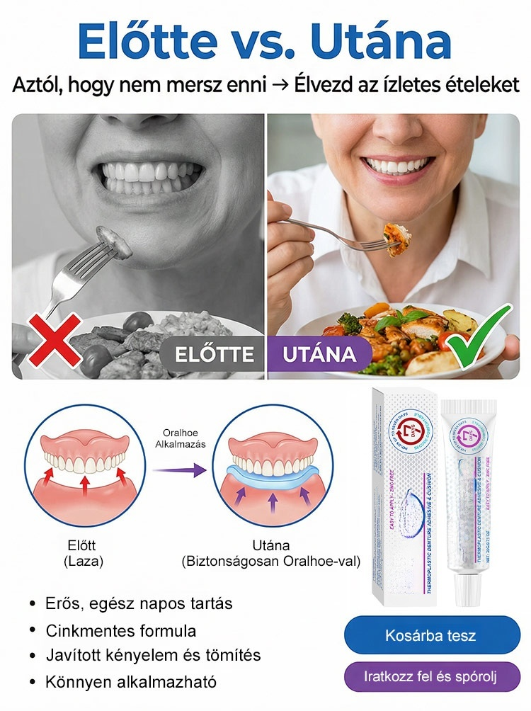 【1 Kenés = 7 Nap Tartás】100% Cinkmentes Hőplasztikus Műfogsor Párna | Zárja ki az Ételmaradékot, Harapj Bátran!