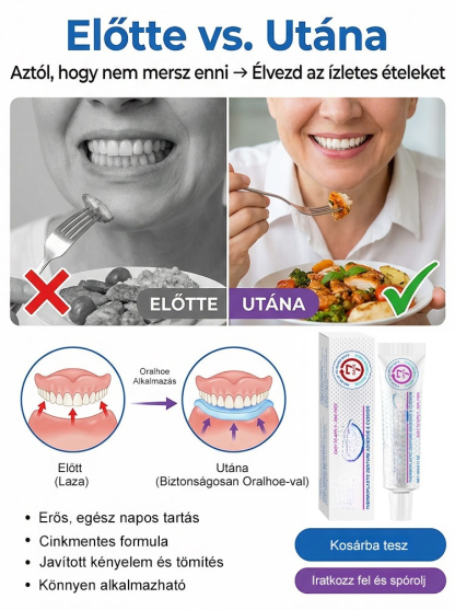【1 Kenés = 7 Nap Tartás】100% Cinkmentes Hőplasztikus Műfogsor Párna | Zárja ki az Ételmaradékot, Harapj Bátran!