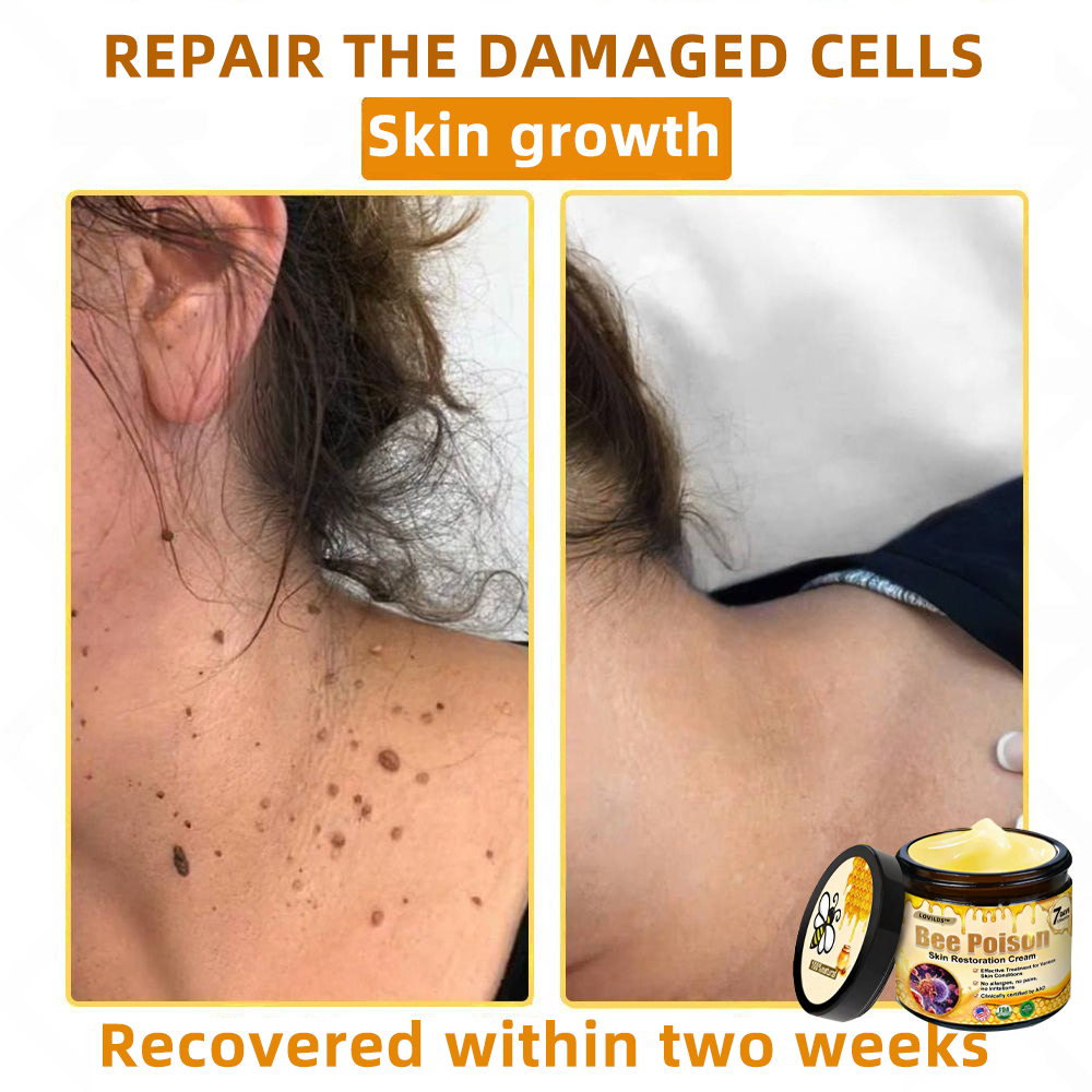 LOVILDS™ 🐝Bee Poison Skin Restoration Cream 🐝