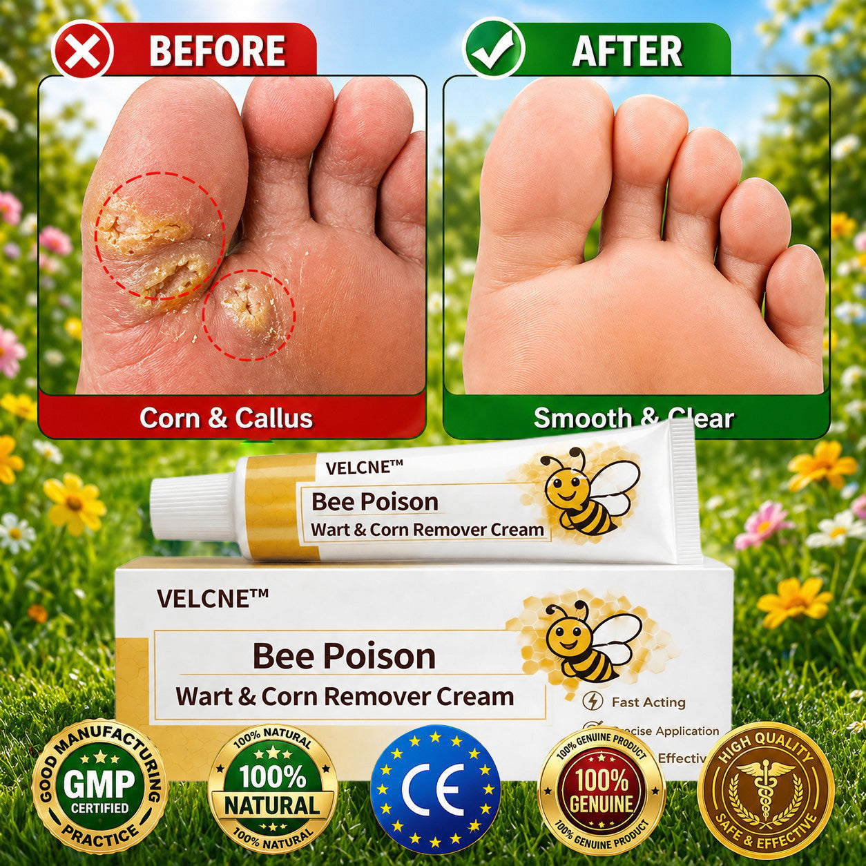 👨‍⚕️Velcne™Bee Poison Wart & Corn Remover Cream⚡