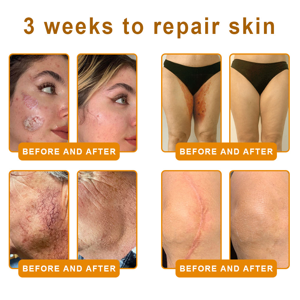 LOVILDS™ 🐝Bee Poison Skin Restoration Cream 🐝