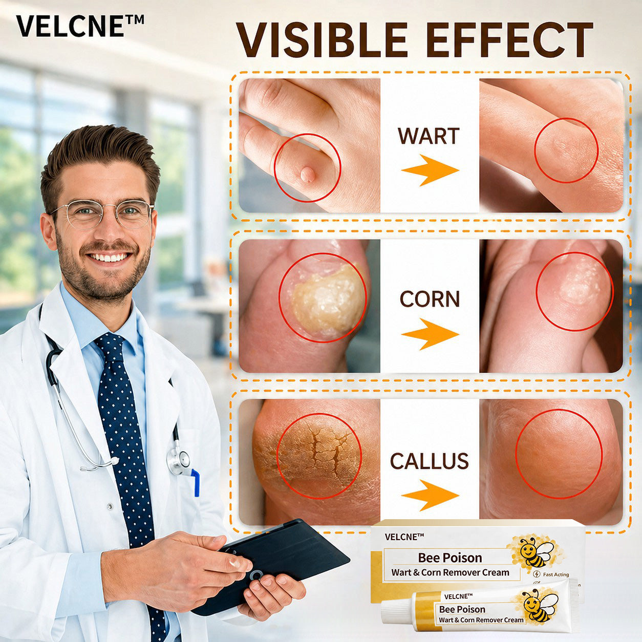 👨‍⚕️Velcne™Bee Poison Wart & Corn Remover Cream⚡