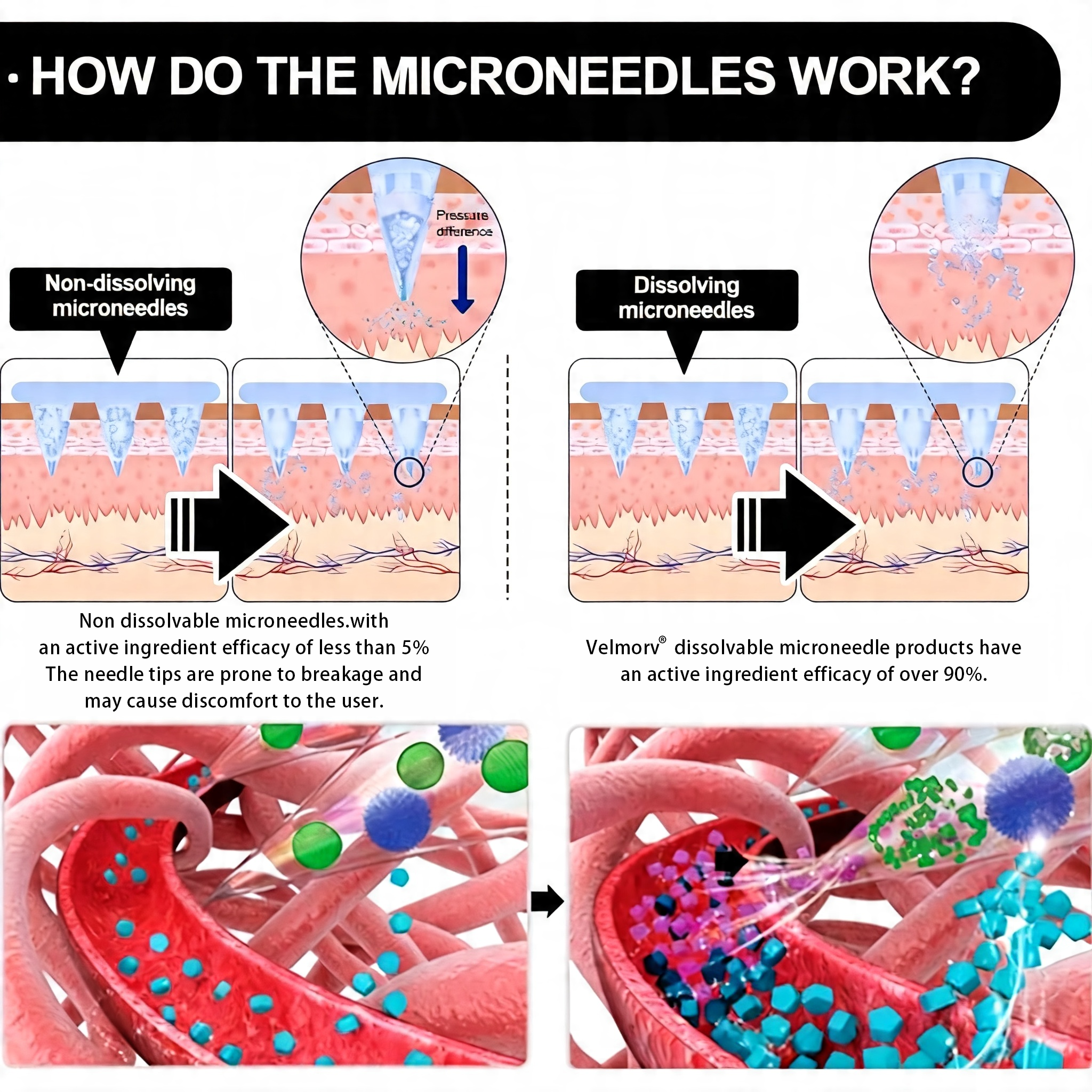 Microneedle structure