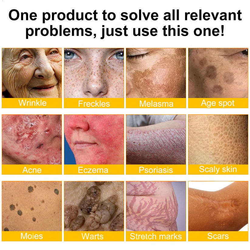 LOVILDS™ 🐝Bee Poison Skin Restoration Cream 🐝
