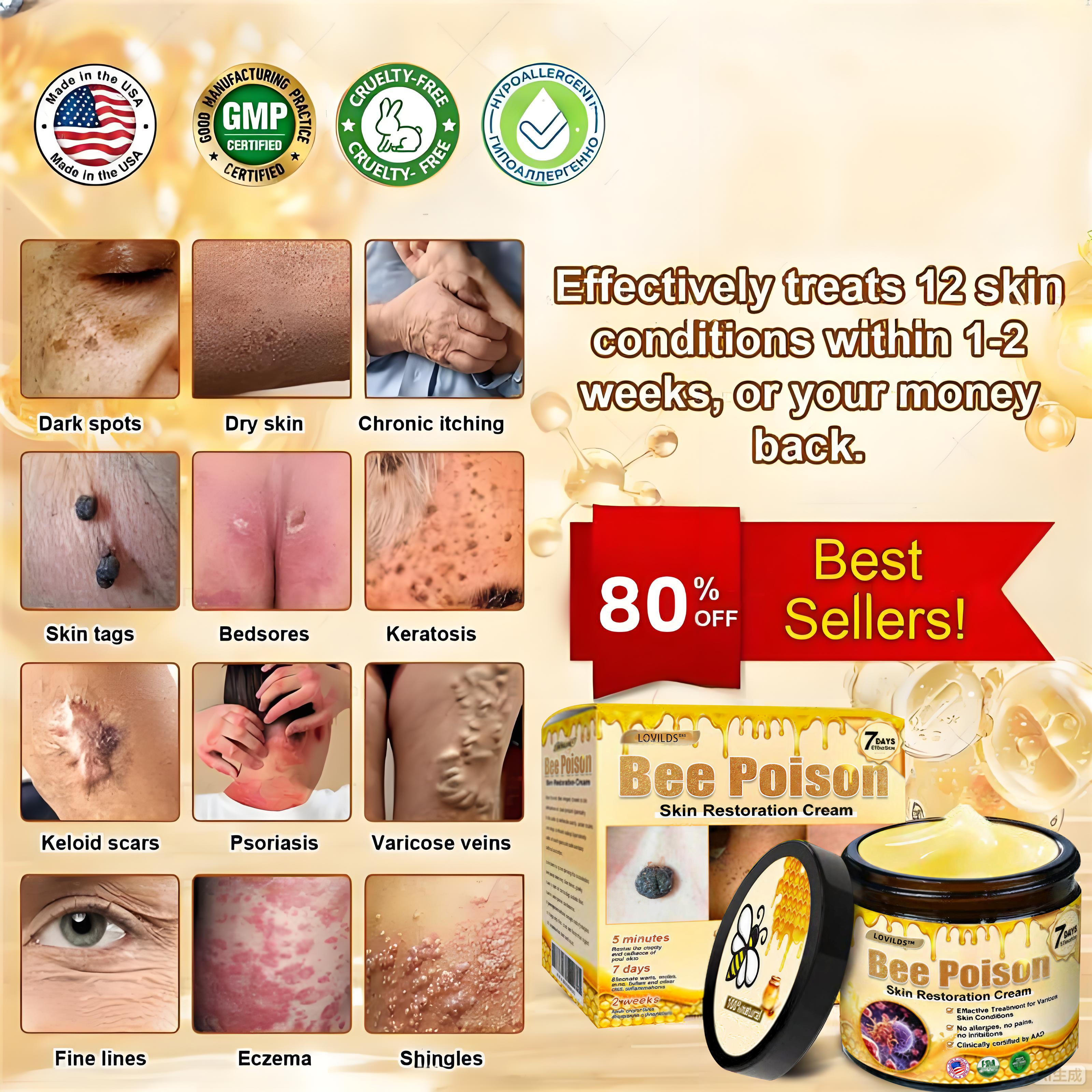 LOVILDS™ 🐝Bee Poison Skin Restoration Cream 🐝